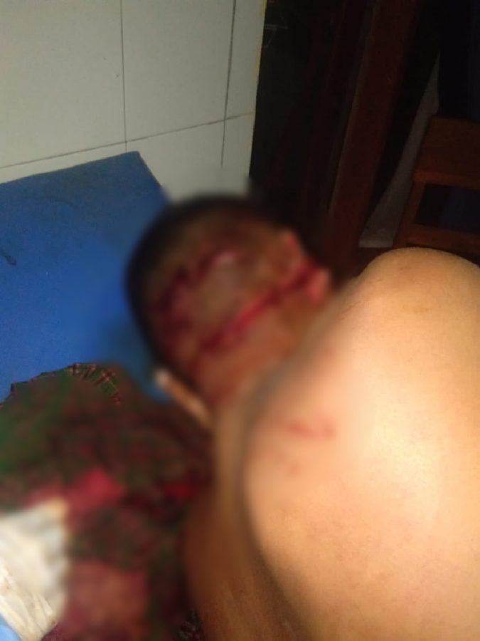 Tengah Bermain Dadu,Seorang Pria Asal Kodi Terkena Sabetan Parang.